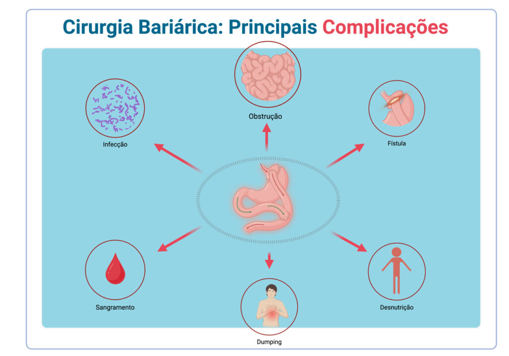 Principais complicacoes da Cirurgia Bariatrica e seus tratamentos