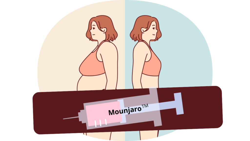 Mounjaro vai substituir a cirurgia bariátrica?