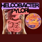 Ilustração do sistema digestivo com destaque para a bactéria Helicobacter pylori em imagem ampliada ao lado do estômago.